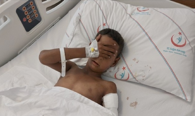 Muğla&#039;da köpeğin saldırısına uğrayan çocuk yaralandı