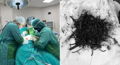 Doktorlar şaşkın... Midesinden 1 kilo metal cisim çıktı!