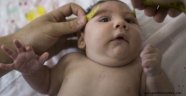 Zika salgını Güney Amerika'da yayılıyor
