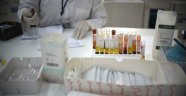 ABD'de 'cinsel yolla bulaşan' Zika vakası