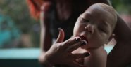 Avrupa'da da görülen Zika virüsü Türkiye'ye gelir mi?